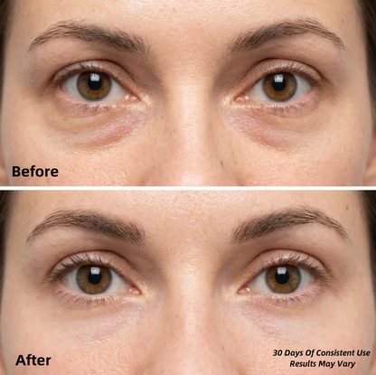 Hydrogel Eye Masks - (30 Pairs)